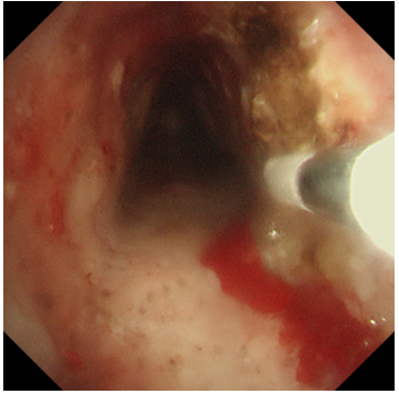 cefeea76-1e23-4c31-a9e8-9562b605596e